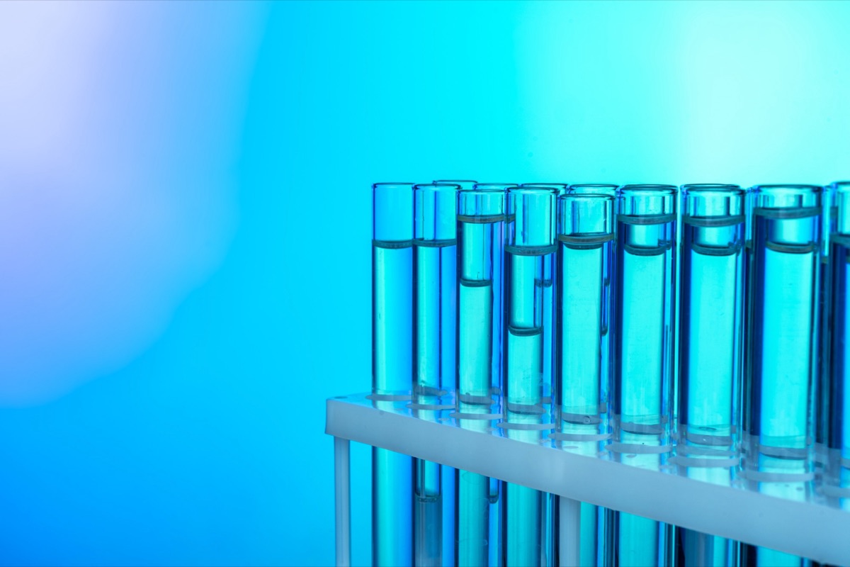 Thrombophilia Tests: When and For Whom Are They Necessary?